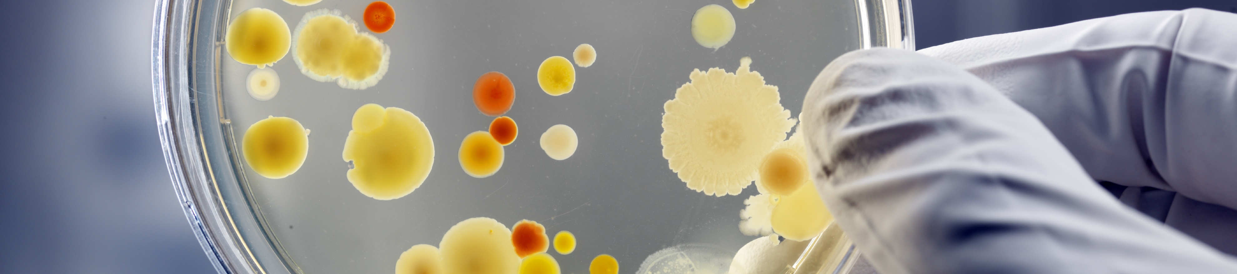 cells in a petri dish